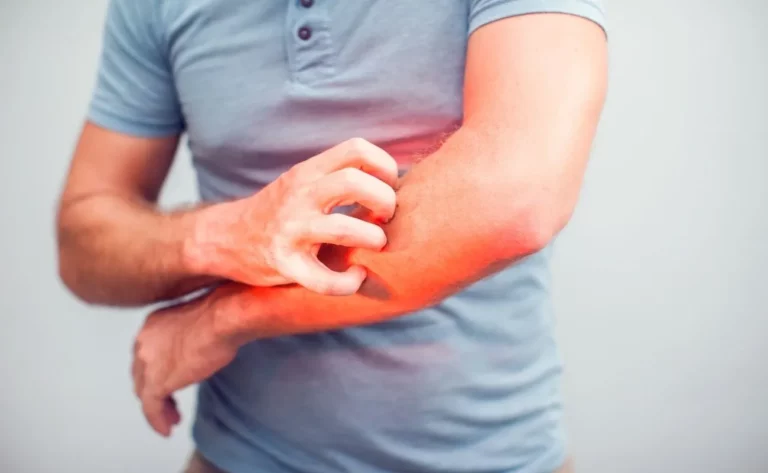 Problemy skórne od spożywania cukru.